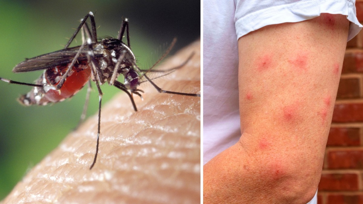 Obtěžují vás v létě na zahradě komáři? Podnikněte proti nim kroky již teď